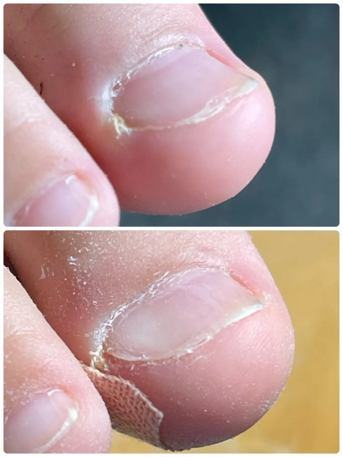 お客様の声⑬Before_and_After