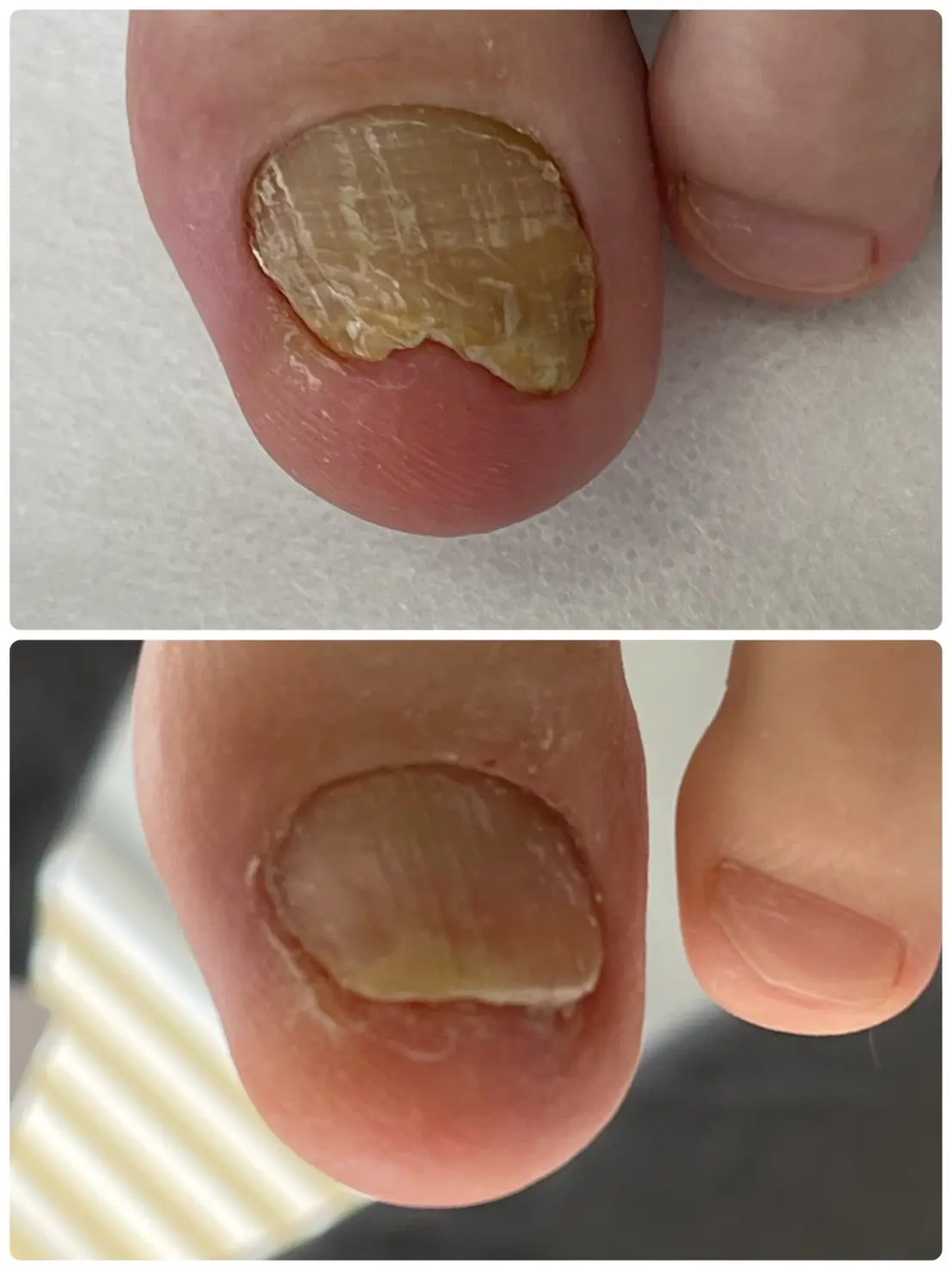 お客様の声⑭Before_and_After